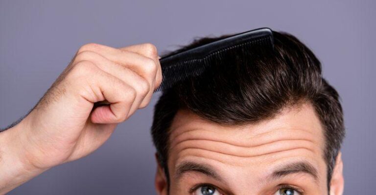 Avoid these 5 things after a hair transplant